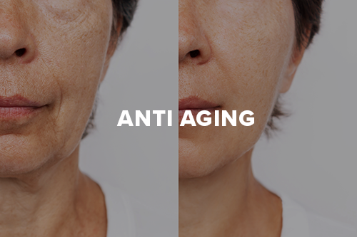 Anti Aging